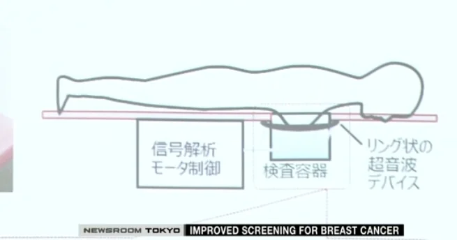 New breast cancer screening technology developed
